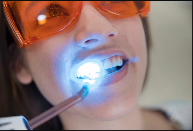 Laser Dentistry