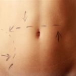 Lower Body fat