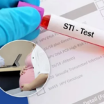 Women’s STI Testing: What Every Woman Needs to Know